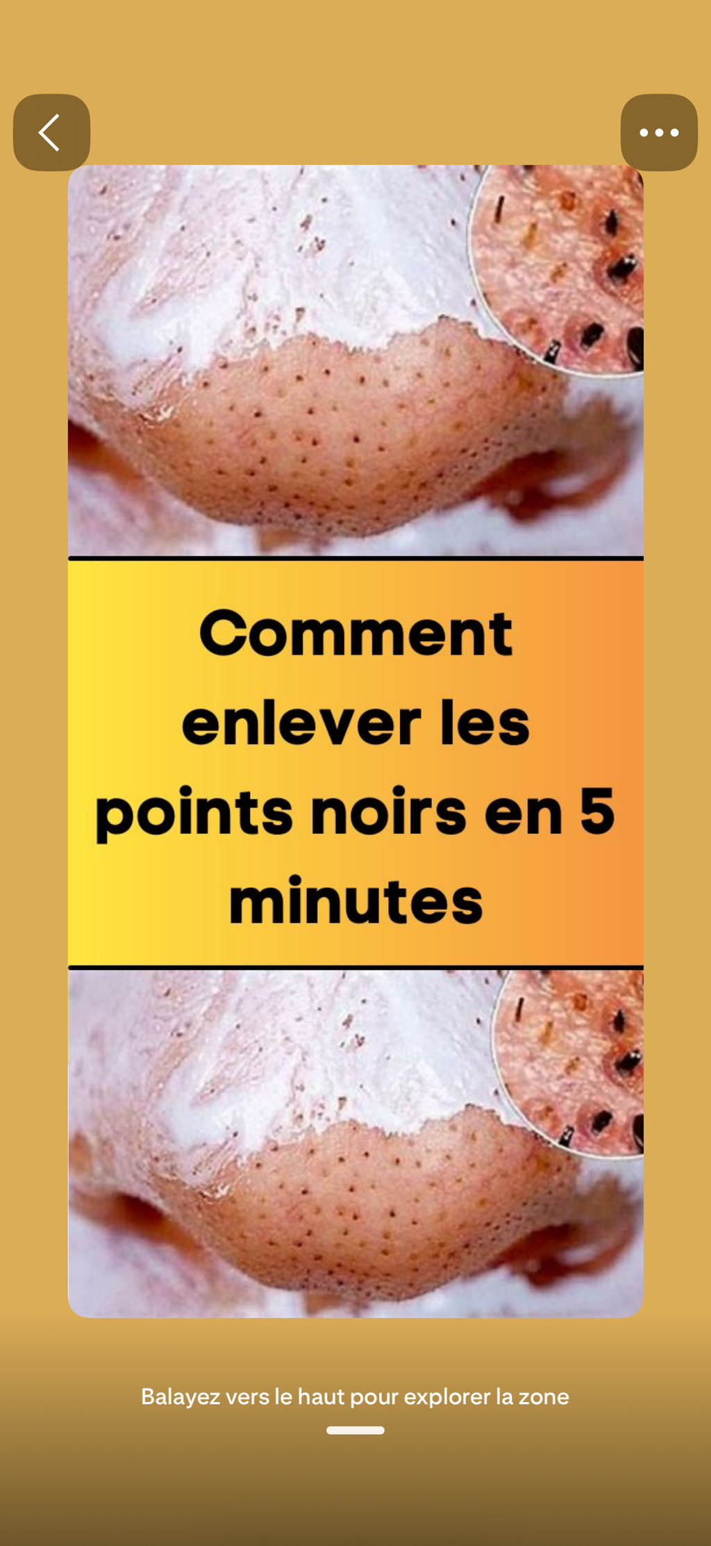 Crème ANTI-POINT NOIR