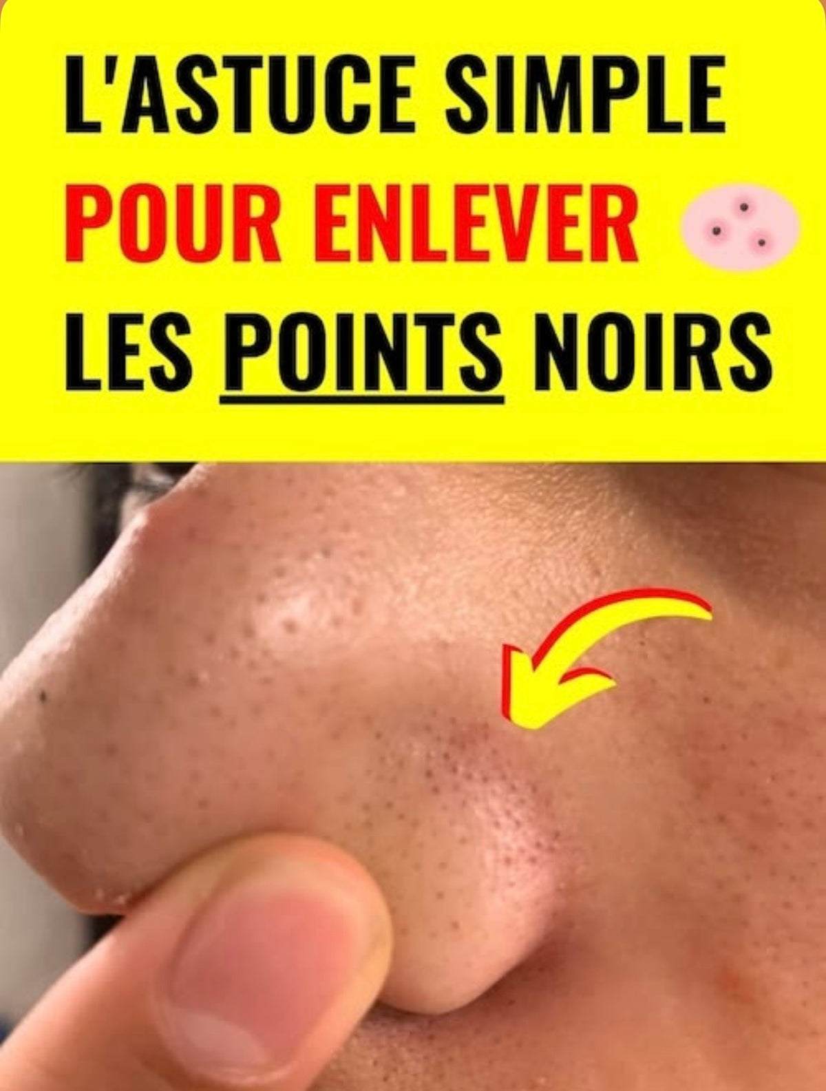 Crème ANTI-POINT NOIR