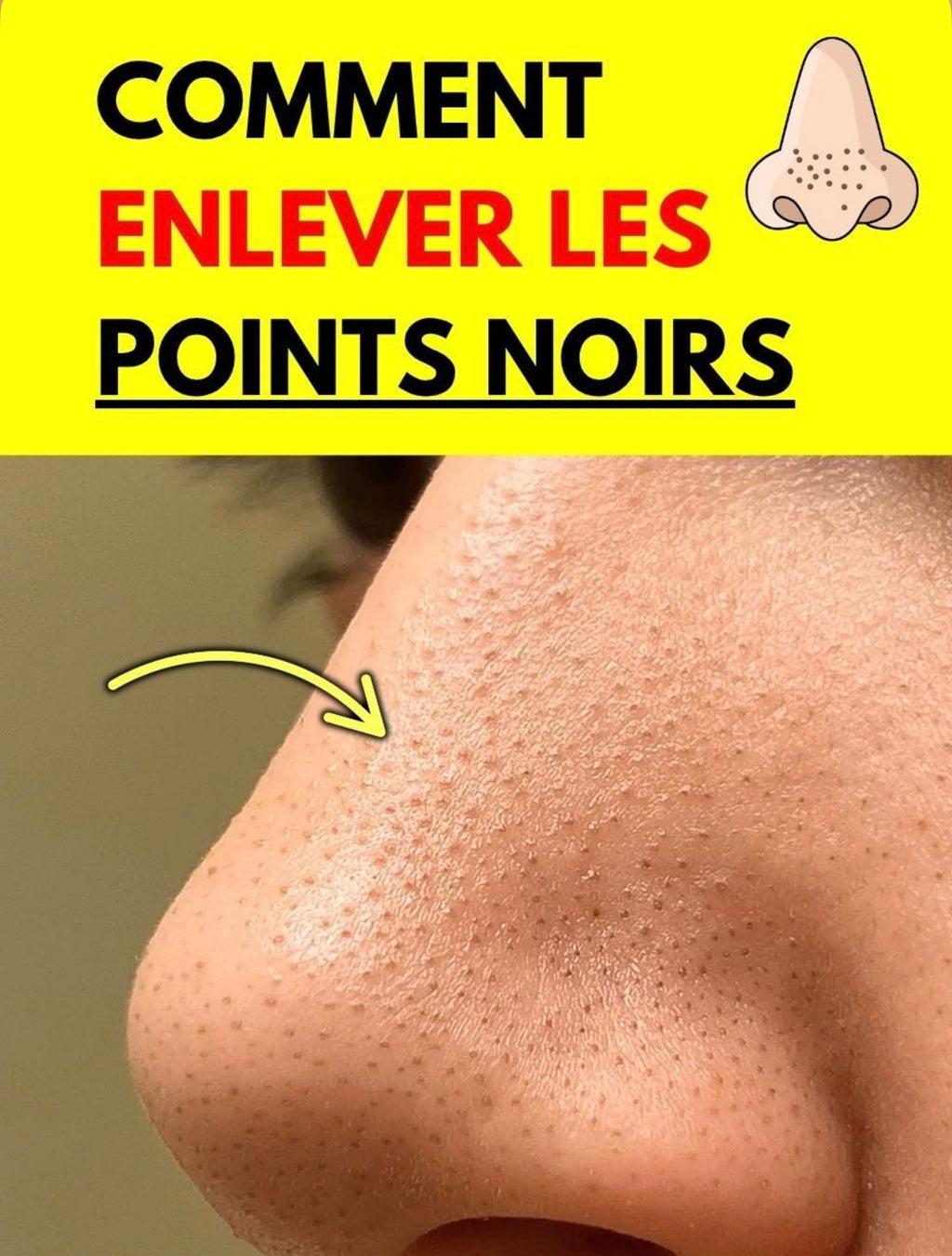 Crème ANTI-POINT NOIR